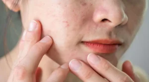 Improves Skin Texture and Glow