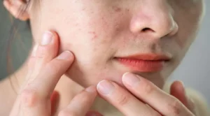 Too many skin products used at once can harm your skin
